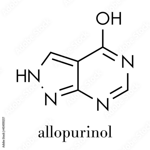 Allopurinol gout drug molecule. Skeletal formula. photo