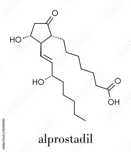Alprostadil (prostaglandin E1) erectile dysfunction drug molecule. Skeletal formula.