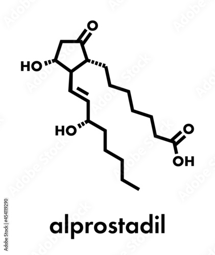 Alprostadil (prostaglandin E1) erectile dysfunction drug molecule. Skeletal formula.