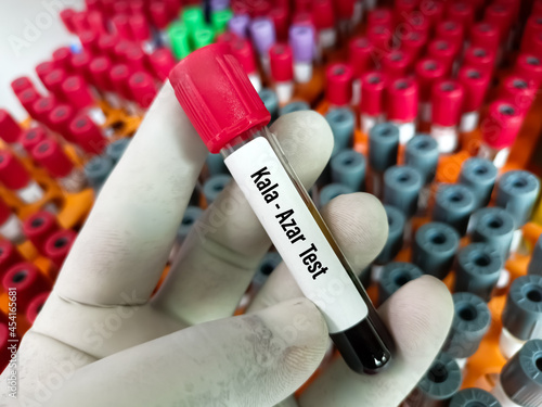 Blood sample for Kala-azar test with laboratory background photo