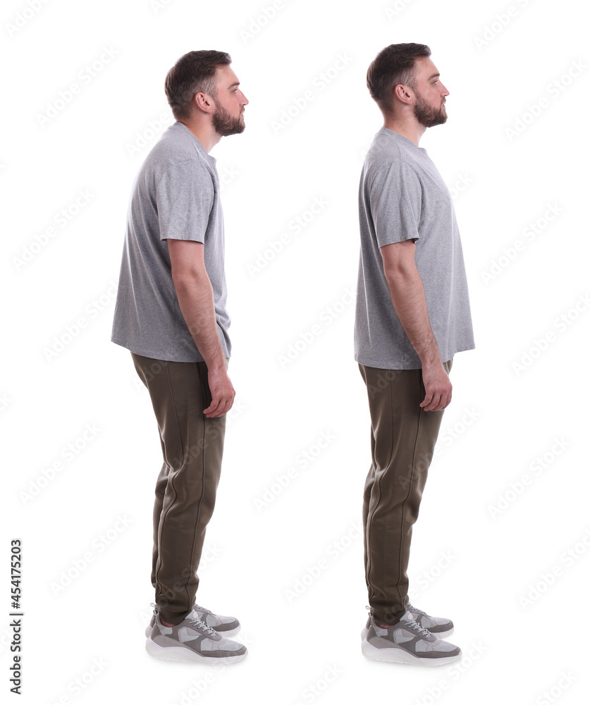 Collage with photos of young man with poor and good posture on white background - obrazy, fototapety, plakaty 