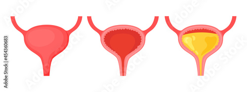 A full and empty bladder. Human organ anatomy. Medical, medical and scientific concepts. Educational infographics