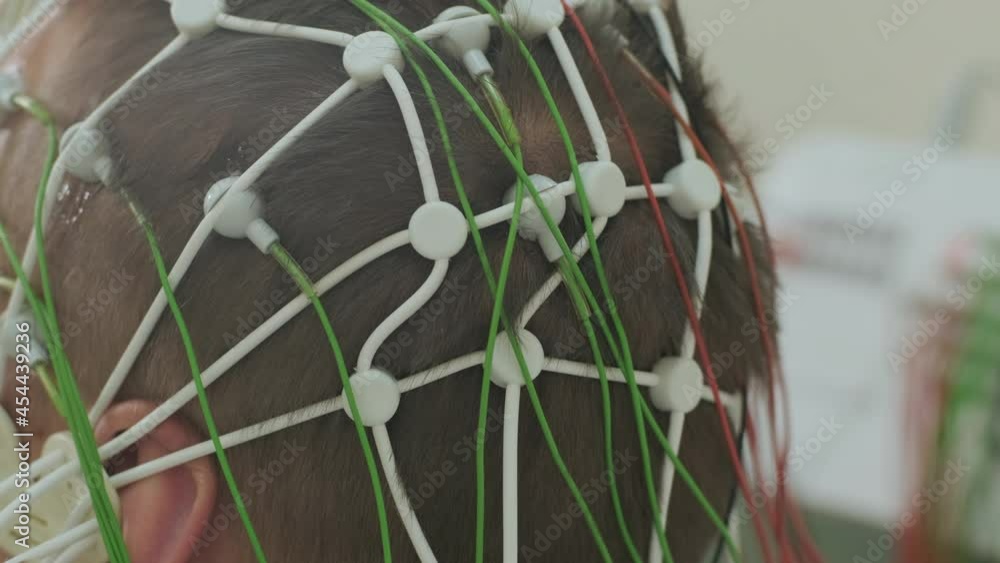 Patient brain testing using encephalography at medical center Patient brain testing using encephalography at medical center