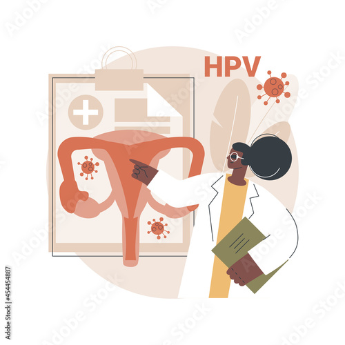 Human papillomavirus HPV abstract concept vector illustration. HPV infection development, skin-to-skin viral infection, human papillomavirus, cervical cancer early diagnostics abstract metaphor.