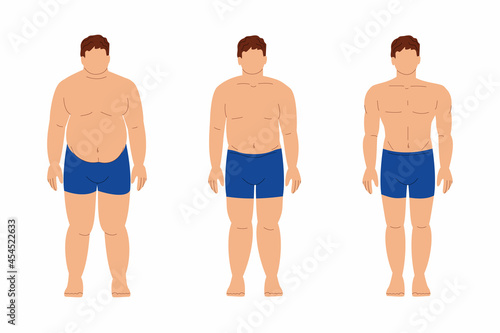 Weight loss stages. Fat obese man is losing weight. Slimming. Stock vector flat cartoon illustration infographics on a white background. © Valentina