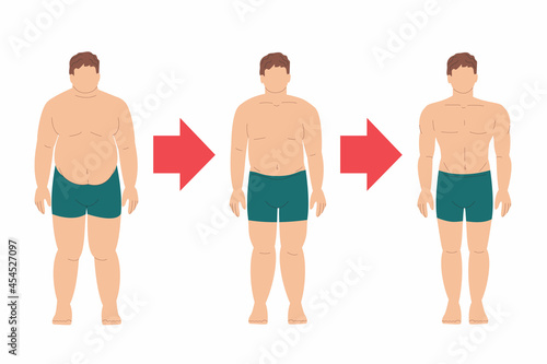 fat male patient losing weight. Before and after. Obesity, overweight and diabetes. Sports, fitness and diet. Schedule, stages of weight loss. Three people. Stock vector illustration on white.