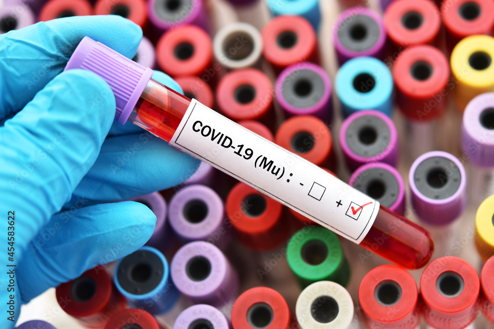 Obraz premium Mu variant COVID-19 positive, blood sample tube positive with mu variant of COVID-19 coronavirus