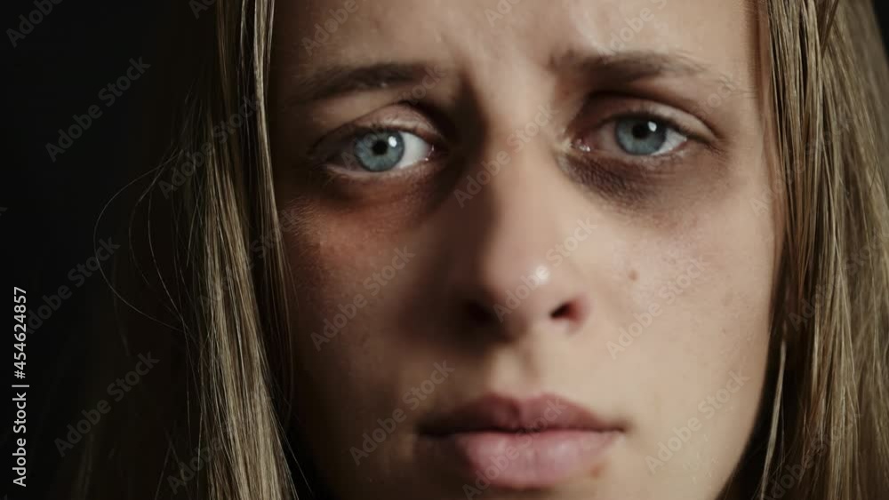 A sad beaten up woman with wounds on face is looking at camera. Female depression because of domestic violence. Need help and support. Concept violence or cruelty and hopelessness or despair. A sad beaten up woman with wounds on face is looking at camera. Female depression because of domestic violence. Need help and support. Concept violence or cruelty and hopelessness or despair.