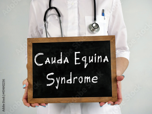Healthcare concept about Cauda Equina Syndrome with sign on the page. photo