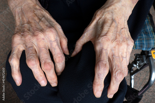 93-year-old elderly person. Close-up of female hands. 93歳の高齢者。 女性の手のクローズアップ。