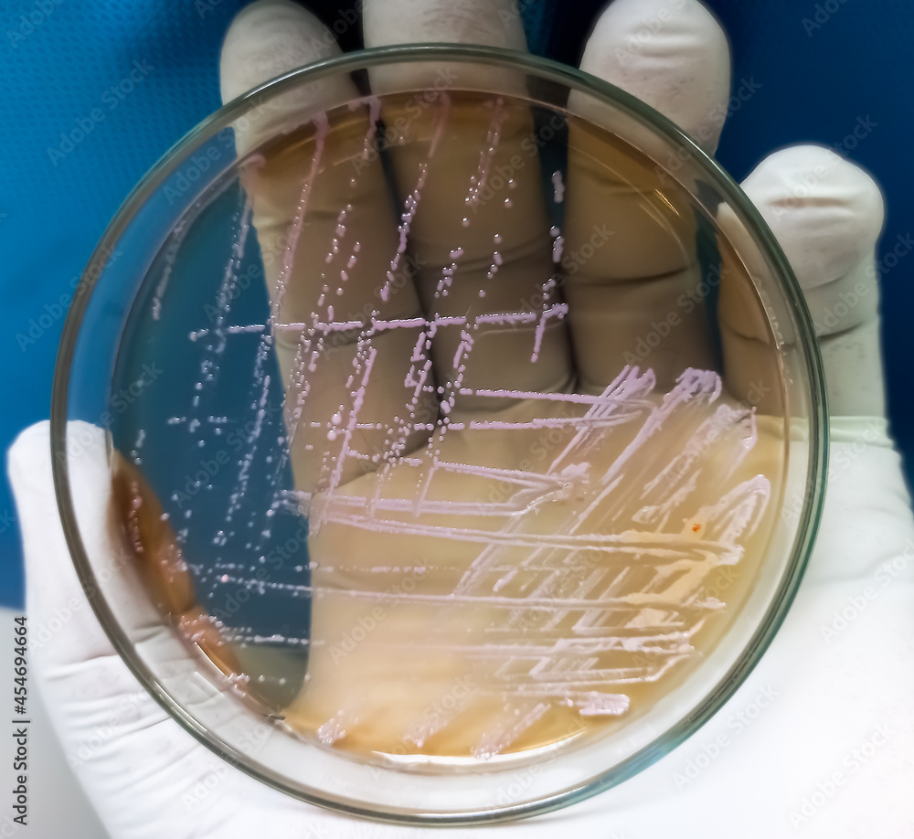 E coli colonies, Gram negative Rods, GNR colonies as test on Salmonella E coli colonies, Gram negative Rods, GNR colonies as test on Salmonella