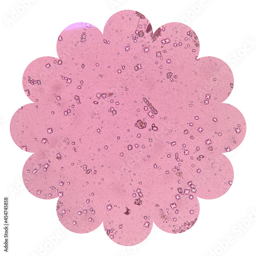 Light microscope of calcium oxalate crystals are shaped like envelopes. Calcium oxalate crystals in elephant's urine sediment. microscopic 40x objective image. photo