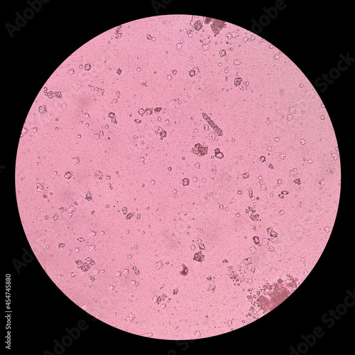 Tableau sur toile Light microscope of calcium oxalate crystals are shaped like envelopes