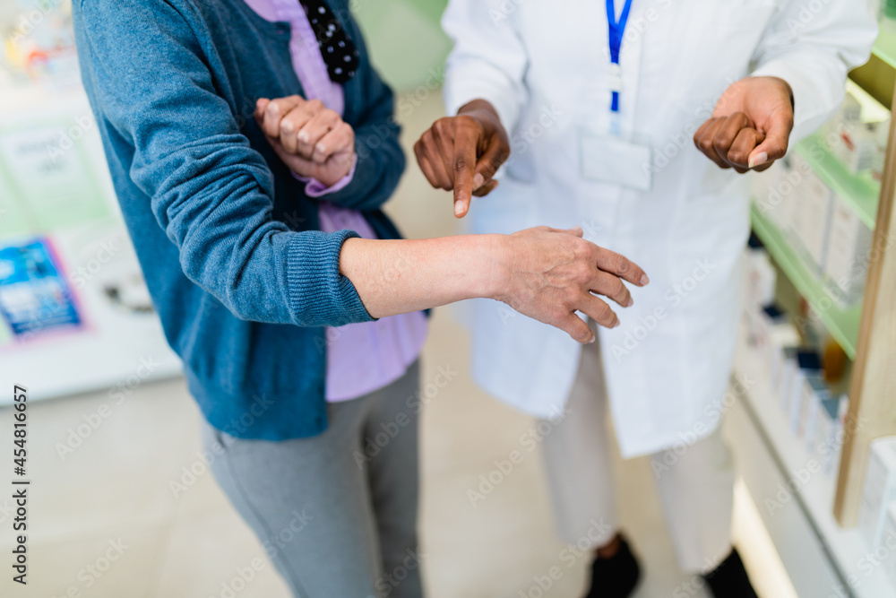 Fototapeta premium Woman shows pharmacist a skin problem she has.