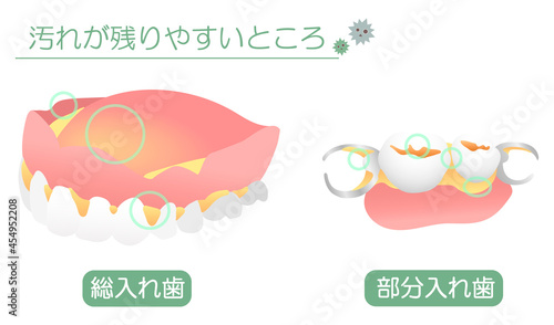 入れ歯の汚れが残りやすいところ