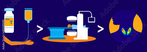 A procedure of a thyroid scintigraphy (SPECT). Vector  flat  illustration. 