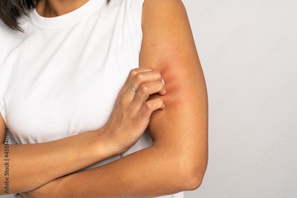 Ταπετσαρία Close up of woman scratching itch on hand, suffer from dry skin or pruritus isolated on studio grey background