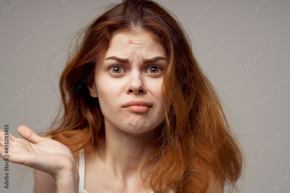 pretty woman facial skin problems dermatology light background pretty woman facial skin problems dermatology light background