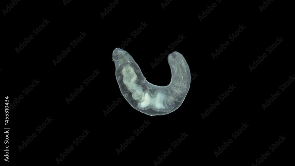 Worm Chaetogaster sp. under the microscope, Class Oligochaeta. Lives in fresh water. They feed by absorbing organisms: algae, Ostracoda, Rotifera, Cladocera ... Worm Chaetogaster sp. under the microscope, Class Oligochaeta. Lives in fresh water. They feed by absorbing organisms: algae, Ostracoda, Rotifera, Cladocera ...