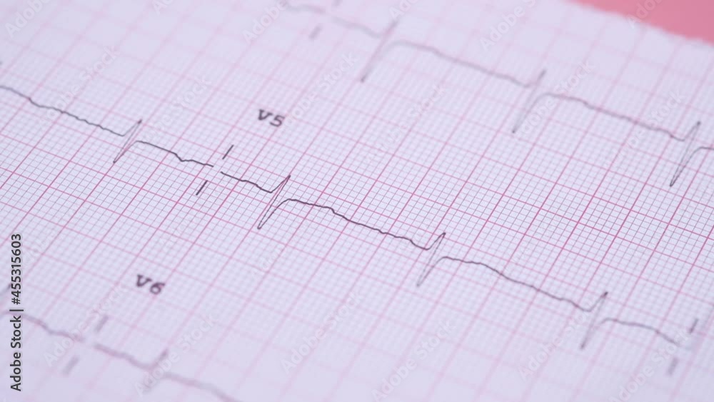 detail shot of cardio diagram on a pink background detail shot of cardio diagram on a pink background