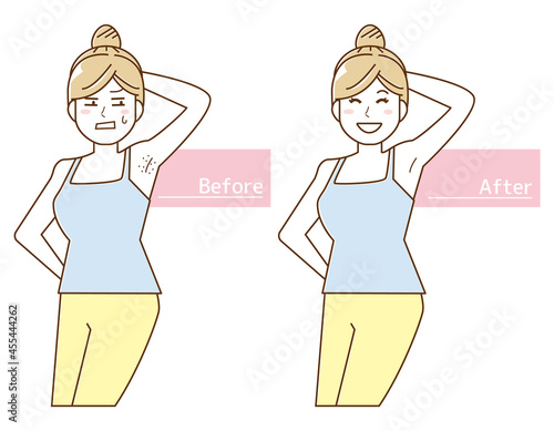 Vector illustration of a woman doing armpit hair removal.