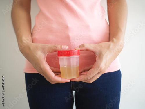 Woman holding a bottle of urine in hand to take a pregnancy test on white background.
