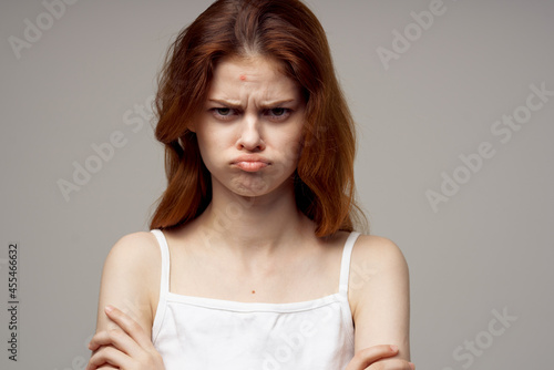 pretty woman in a white t-shirt pimples on the face isolated background