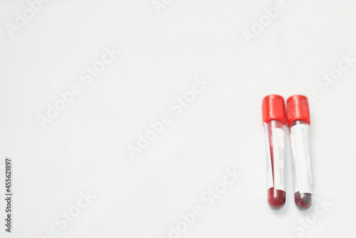 blood sample tubes for lab test with copy space