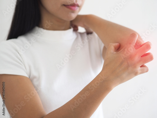 Asian woman scratching her arm and red elbow from allergy. dry skin, dermatitis, insect bites, irritation, rash concept. closeup photo, blurred.