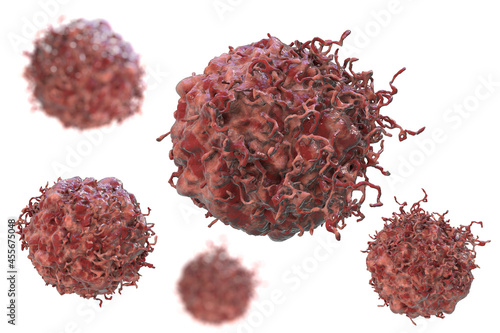 Принти на полотні Cancer cells, 3D illustration