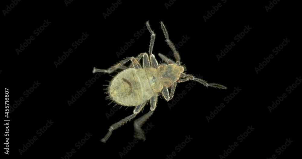 Bed bug nymph Cimex lectularius under a microscope, order Hemiptera, family Cimicidae. Feeds on human blood. Initial stage