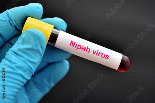 Blood sample tube positive with Nipah virus test photo