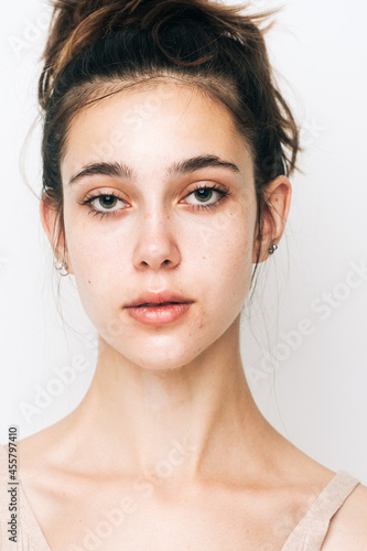 Woman With Real Skin Imperfections Portrait