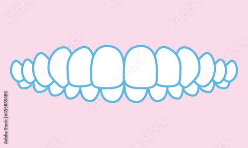 歯並びのイラスト