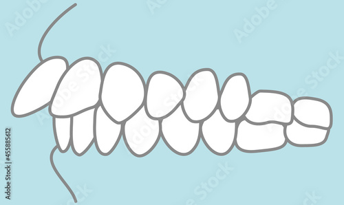 歯並びのイラスト