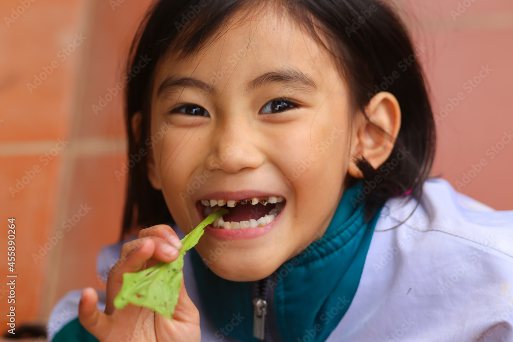 a young little girl is laughing with decayed teeth and leaf mustard on her hand a young little girl is laughing with decayed teeth and leaf mustard on her hand