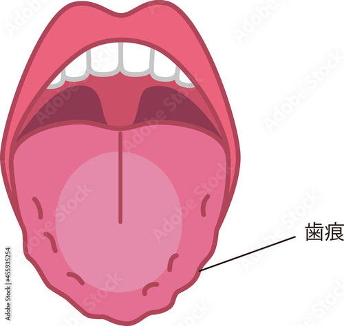 舌の健康についてのイラスト