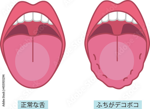 舌の健康についてのイラスト