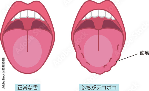 舌の健康についてのイラスト