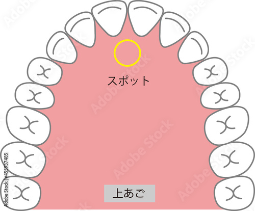 正しい舌の位置のイラスト