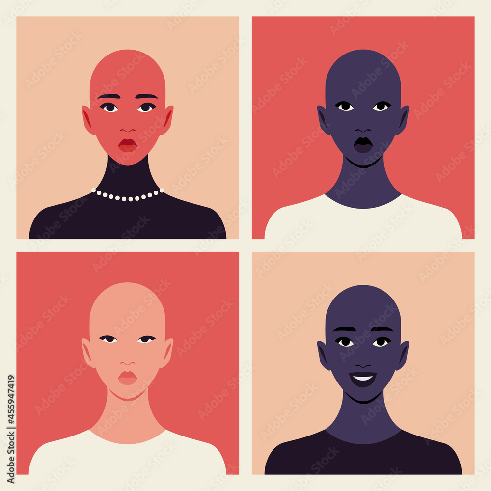 Set of faces of bald young women. Alopecia and hair loss. Oncology, dermatology and trichology. Vector flat Illustration Set of faces of bald young women. Alopecia and hair loss. Oncology, dermatology and trichology. Vector flat Illustration