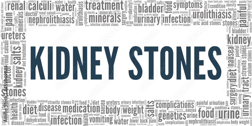 Kidney Stones vector illustration word cloud isolated on a white background.