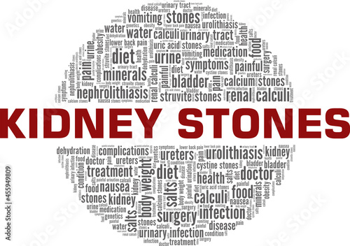 Kidney Stones vector illustration word cloud isolated on a white background.