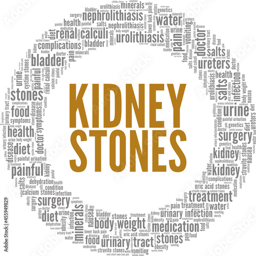 Kidney Stones vector illustration word cloud isolated on a white background.