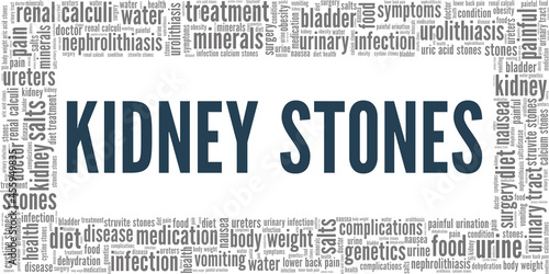 Kidney Stones vector illustration word cloud isolated on a white background.