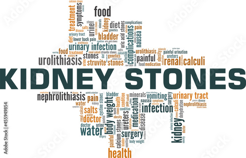 Kidney Stones vector illustration word cloud isolated on a white background.