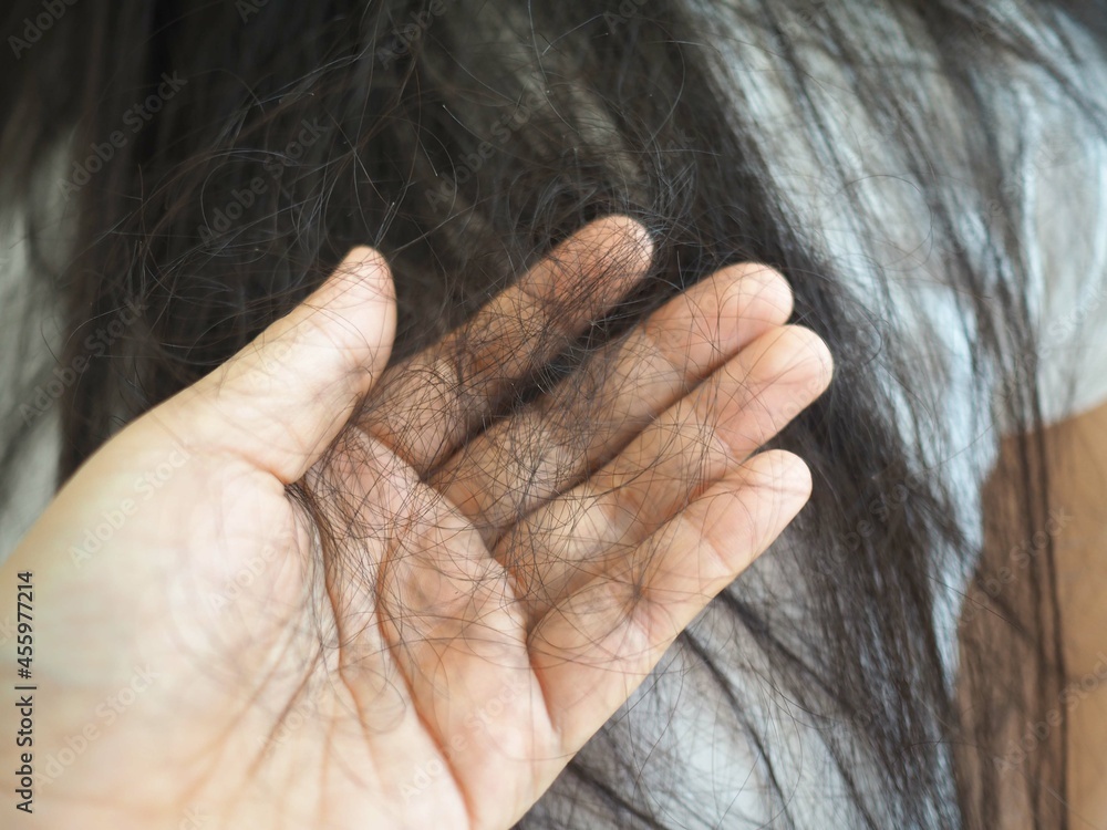 Fototapeta premium Hair loss in woman hands, hair product concept. closeup photo, blurred.