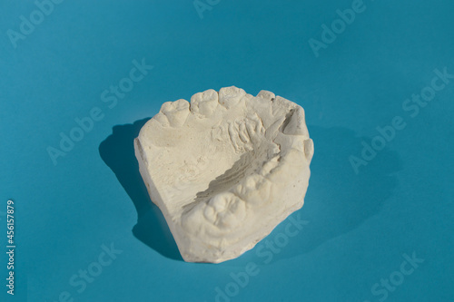 Dental model plaster cast or mould human jaws prothetic on background photo