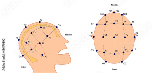 EEG (electroencephalography) Electrodes placement International System 10-20.  photo