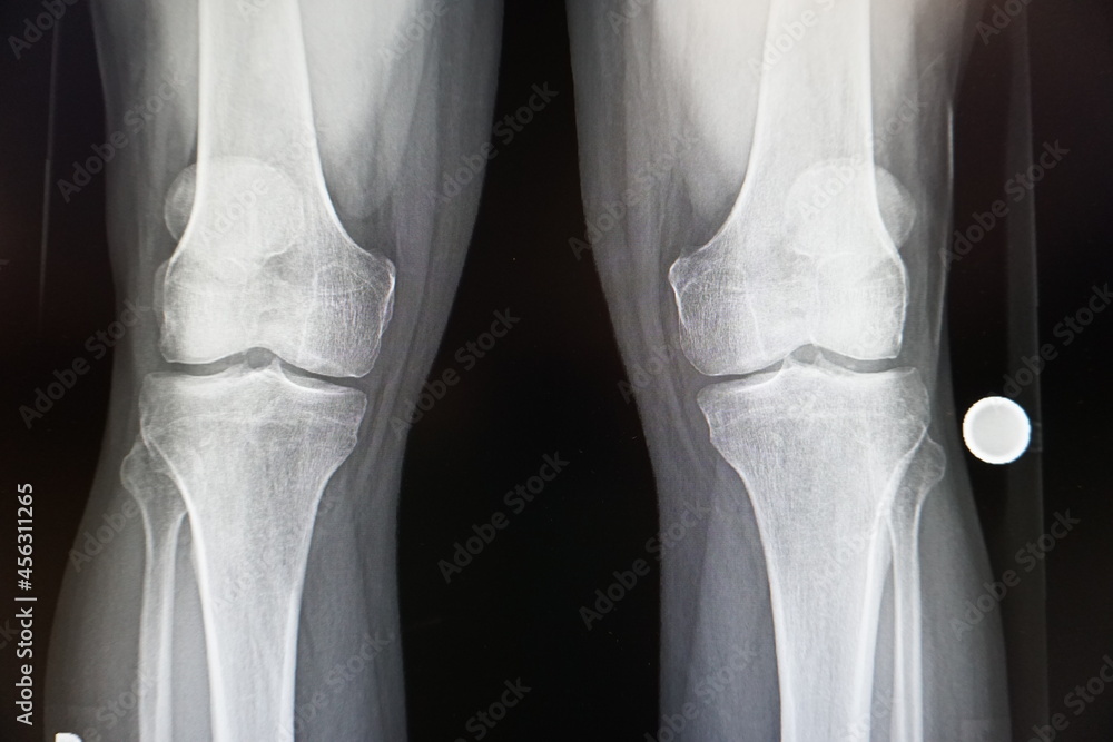 Medical imaging for orthopedic surgery Medical imaging for orthopedic surgery